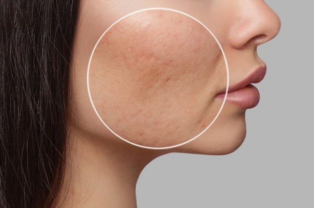 معرفی بهترین ژل شستشوی صورت برای منافذ باز پوست